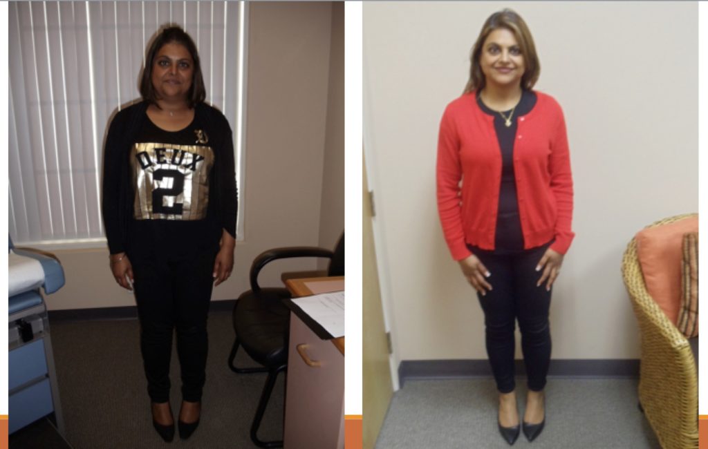 Medical Weight Loss – Before and After Photos