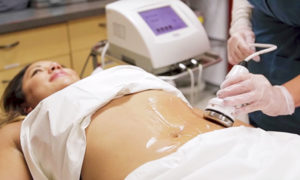 Example of cavitation being done on a patient.